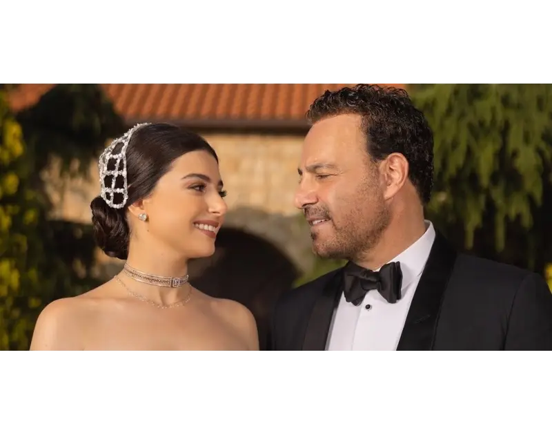 تقع في المتن.. شاهدوا فخامة فيلا الفنان عاصي الحلاني التي يملكها إلى جانب مزرعته في الحلانية (صور) تعرف على التالي تقع في المتن.. شاهدوا فخامة فيلا الفنان عاصي الحلاني التي يملكها