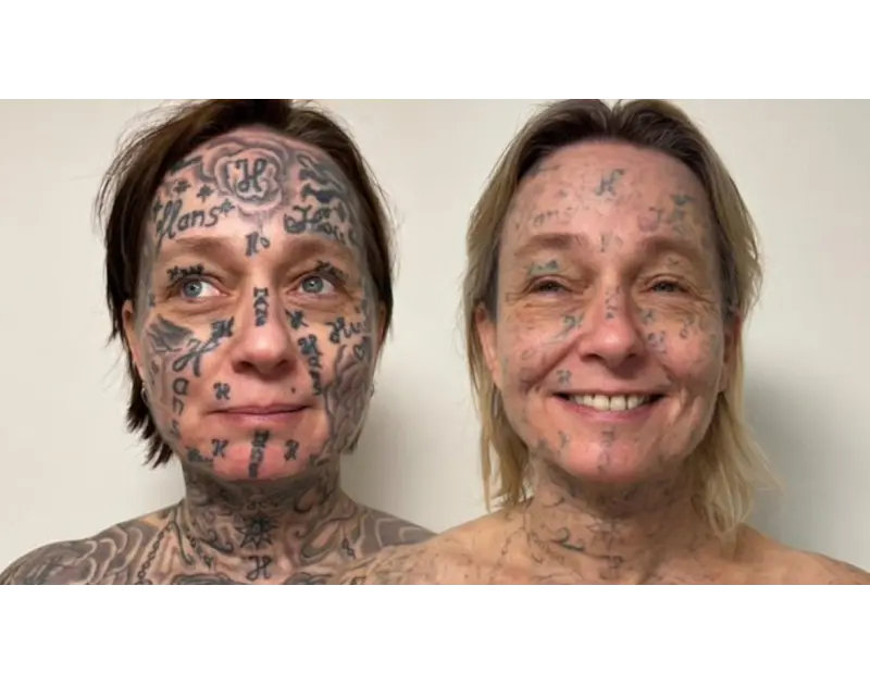 لتمييزها كملكية خاصة. هولندية تزيل 250 وشمًا رسمها حبيبها على جسدها (صور)