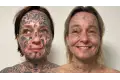 لتمييزها كملكية خاصة. هولندية تزيل 250 وشمًا رسمها حبيبها على جسدها (صور)