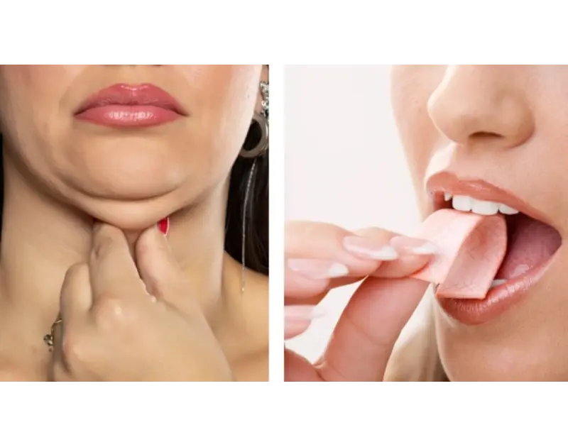 مضغ العلكة يعالج مشكلة الذقن المزدوج. حقيقة أم خرافة