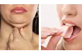 مضغ العلكة يعالج مشكلة الذقن المزدوج. حقيقة أم خرافة