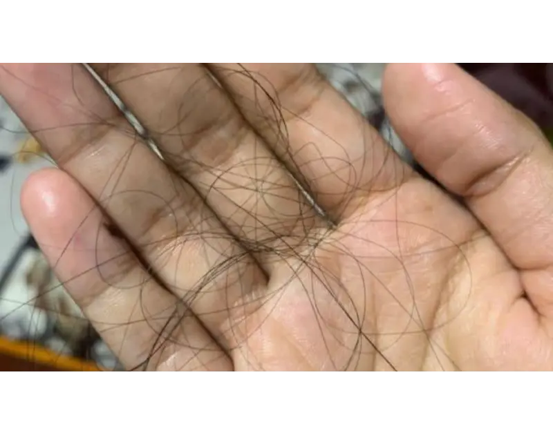أخطاء شائعة عند استخدام الزيوت قد تزيد تساقط الشعر بدلًا من علاجه