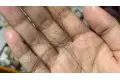 أخطاء شائعة عند استخدام الزيوت قد تزيد تساقط الشعر بدلًا من علاجه
