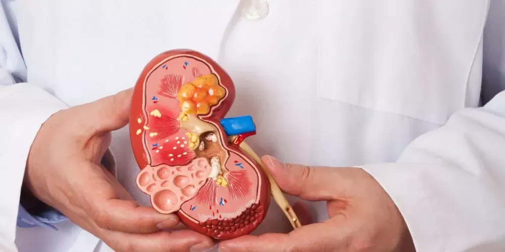 وداعاً لآلام الأملاح والحصوات.. 5 أطعمة ومشروبات تنظف كليتك في بيتك