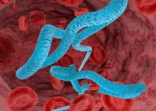 مأساة الإيبولا في الكونغو.. أرقام مفزعة وتحديات كبيرة بتواجه العالم
