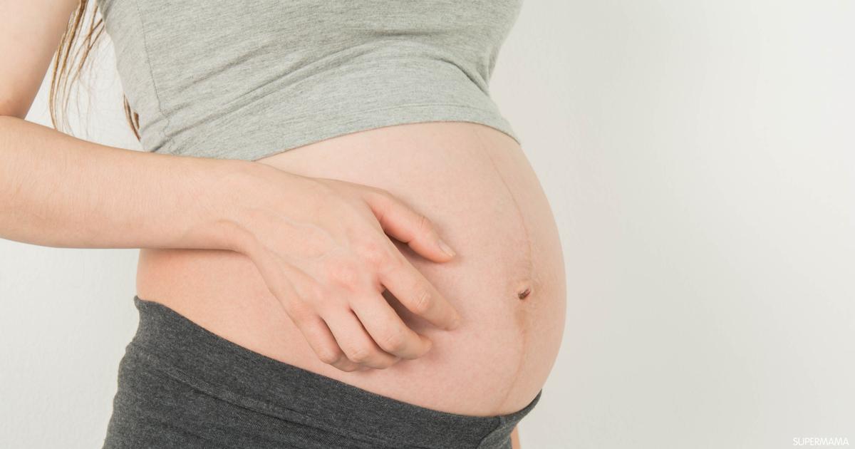 أفضل حبوب حساسية للحامل من الصيدلية مجربة 